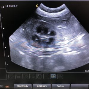 אולטרסאונד בטן - סדנה מעשית לקלינאי 3-11-19